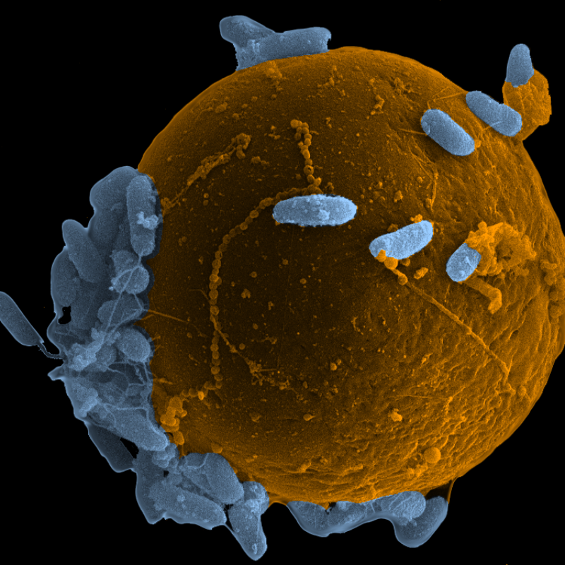 Bacteria covering a cell surface, showing a high level of bacterial growth.