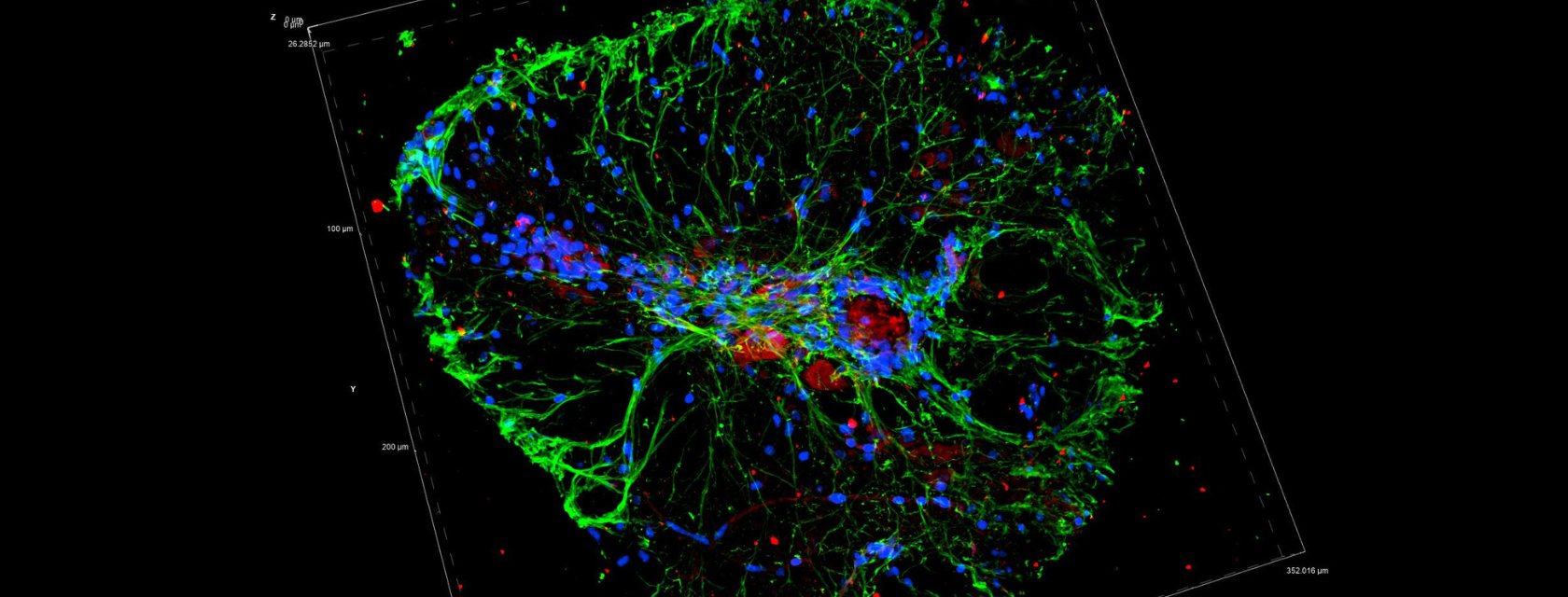 microscopic image of brain tissue