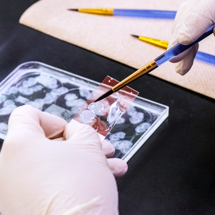 Slides of tiny brain tissue