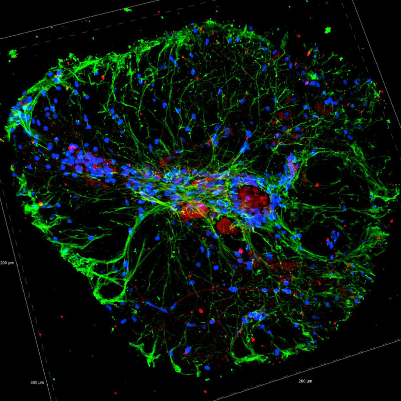 microscopic image of organoid