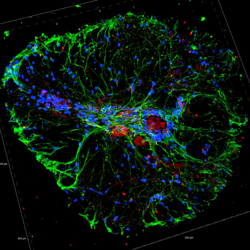 A digital illustration of a brain illuminated with vibrant green and blue lights.