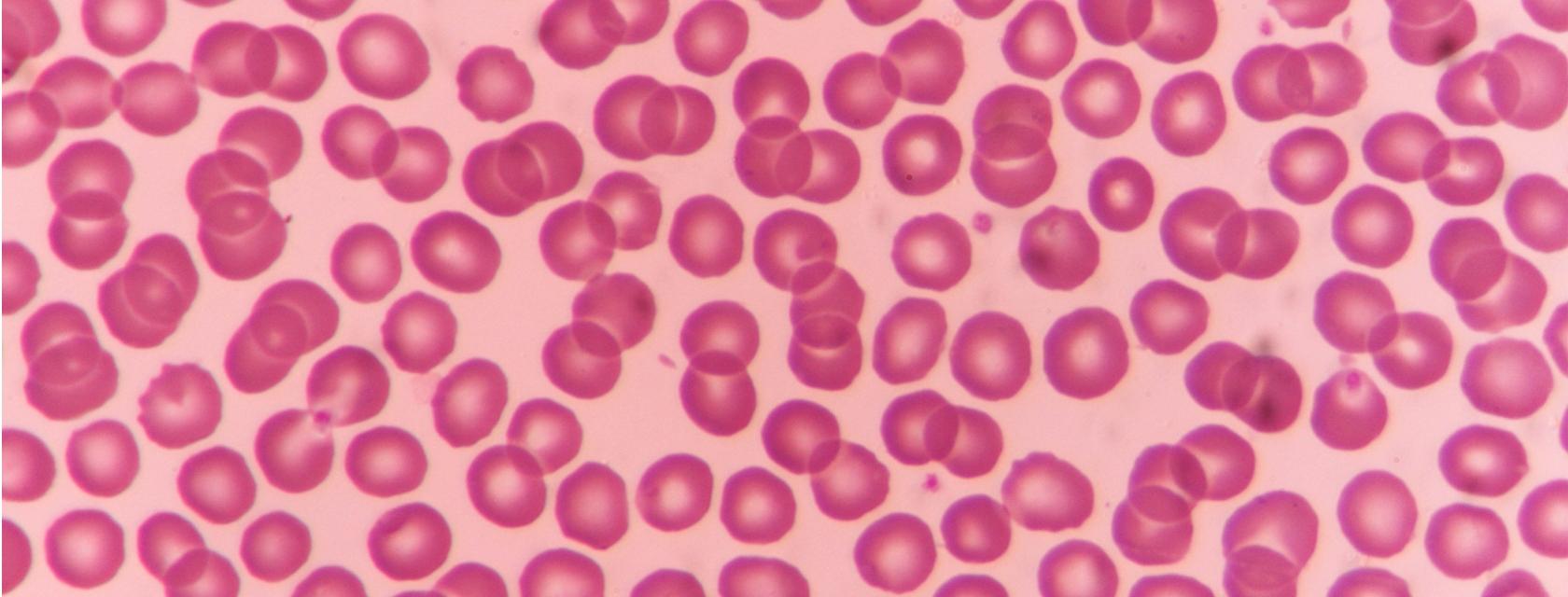 microscopic image of red blood cells