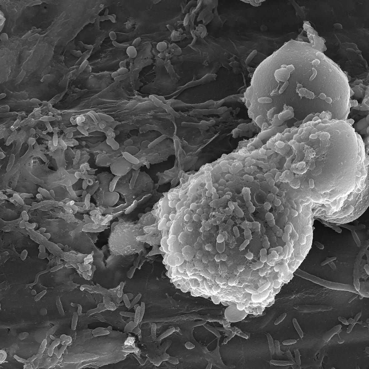 Electron micrograph of feed
