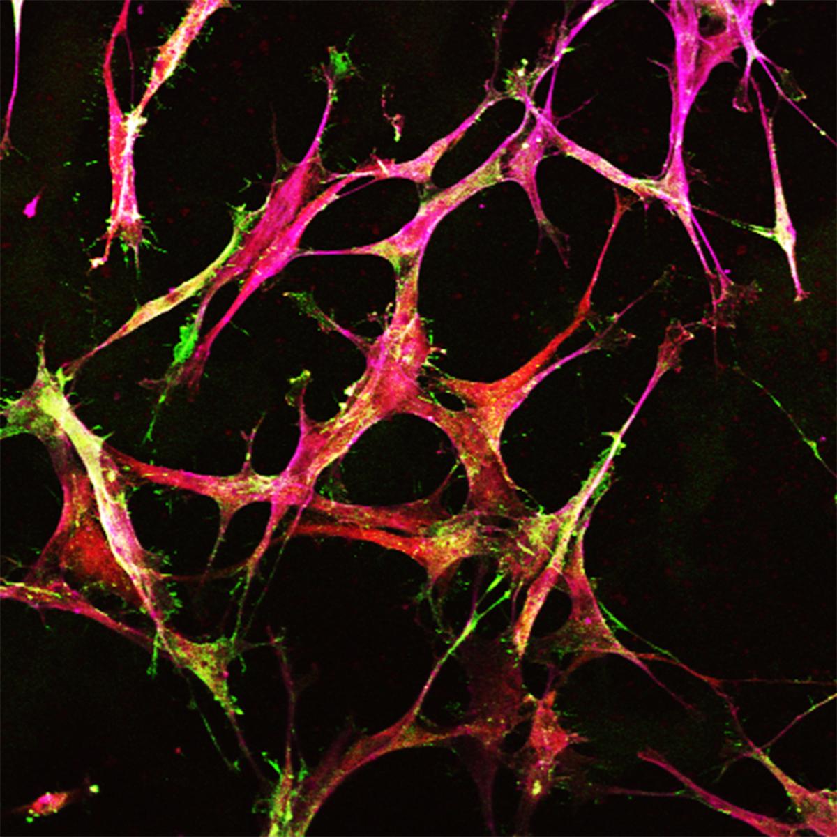 Cancer cells